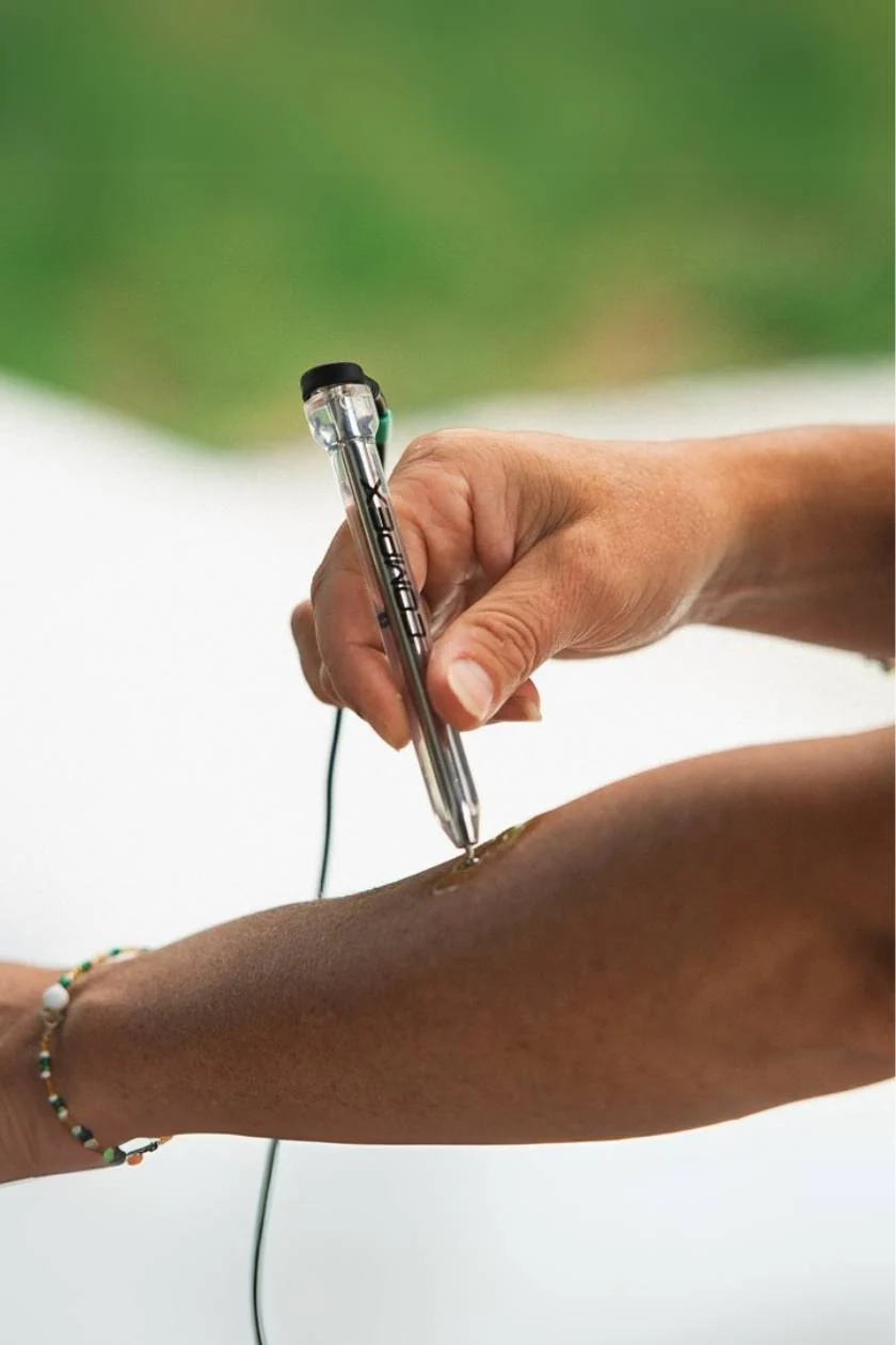 COMPEX MOTOR POINT PEN & ELECTRODE GEL - Image 2